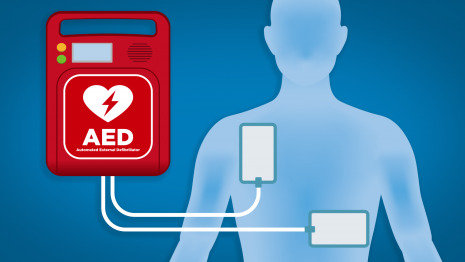 醫用護理床：黃金搶救4分鐘，使用CPR，AED指南！