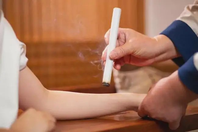 艾灸和拔罐的注意事項！